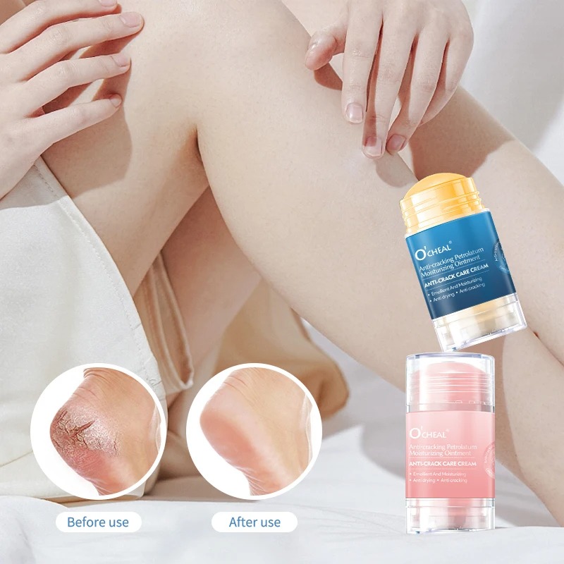 Heels - Anti-Riss-Fußcreme für trockene und rissige Füße